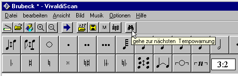 Intelligente Rhythmuskontrolle von VivaldiScan 